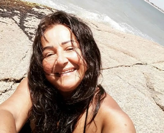Médico é preso por morte de dona de casa durante lipoaspiração