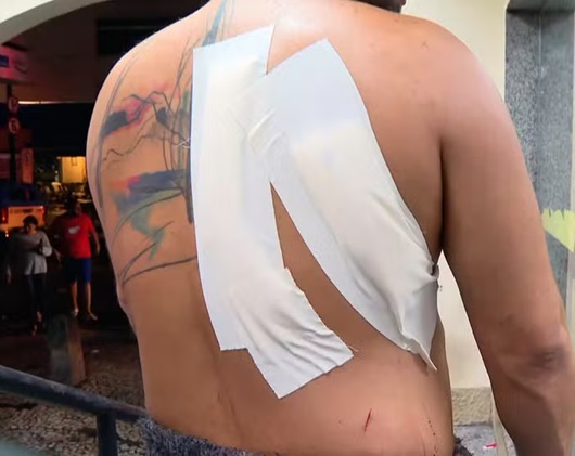 Duas pessoas são esfaqueadas em arrastão após bloco de carnaval no Rio
