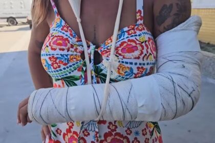 Mulher trans é agredida a pauladas por cinco homens, em Cabo Frio