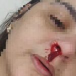 Funcionária de clínica veterinária em Campos é agredida por cliente  