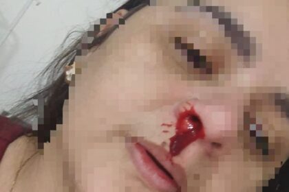 Funcionária de clínica veterinária em Campos é agredida por cliente  