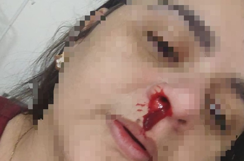 Funcionária de clínica veterinária em Campos é agredida por cliente  