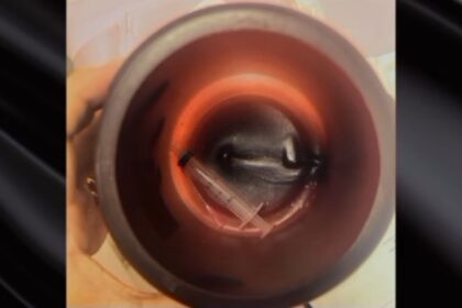 Vigilância Sanitária de Campos faz interdição imediata em clínica de estética devido a más condições de higiene