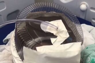 Hospital usa embalagem de bolo como máscara de oxigênio em bebê de 3 meses que esperava UTI