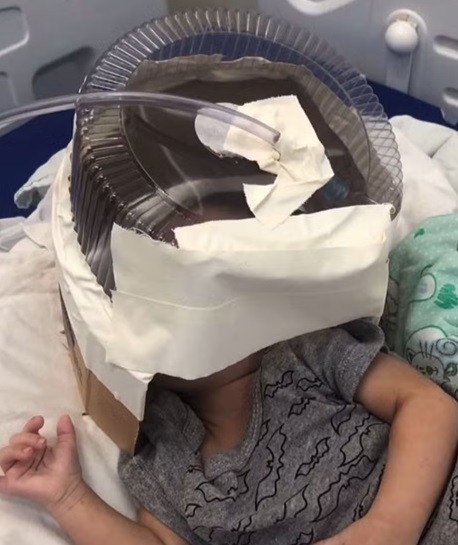 Hospital usa embalagem de bolo como máscara de oxigênio em bebê de 3 meses que esperava UTI