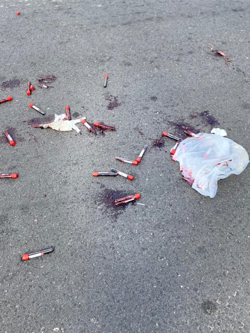Amostras de sangue são descartadas na Rua Doutor Siqueira, em Campos