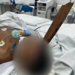 Carpinteiro fica com estaca de madeira cravada no crânio após acidente de trabalho no Rio