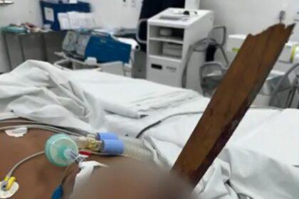 Carpinteiro fica com estaca de madeira cravada no crânio após acidente de trabalho no Rio