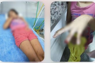 Menina de 8 anos que perdeu parte do dedo é a segunda criança a se acidentar em pracinhas em 40 dias