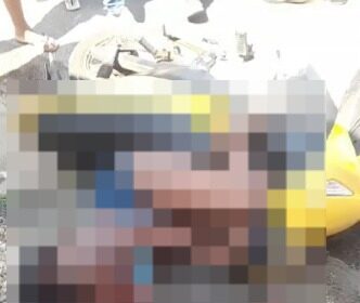 Mulher fica em estado grave após ser baleada em Guarus