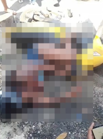 Mulher fica em estado grave após ser baleada em Guarus