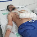 Homem diz que foi agredido com paralelepípedo ao passar por trecho de atropelamento na BR-101, em Travessão