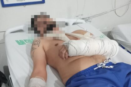 Homem diz que foi agredido com paralelepípedo ao passar por trecho de atropelamento na BR-101, em Travessão
