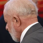 Lula passa por novo procedimento para evitar sangramento na cabeça e já está acordado, diz médico