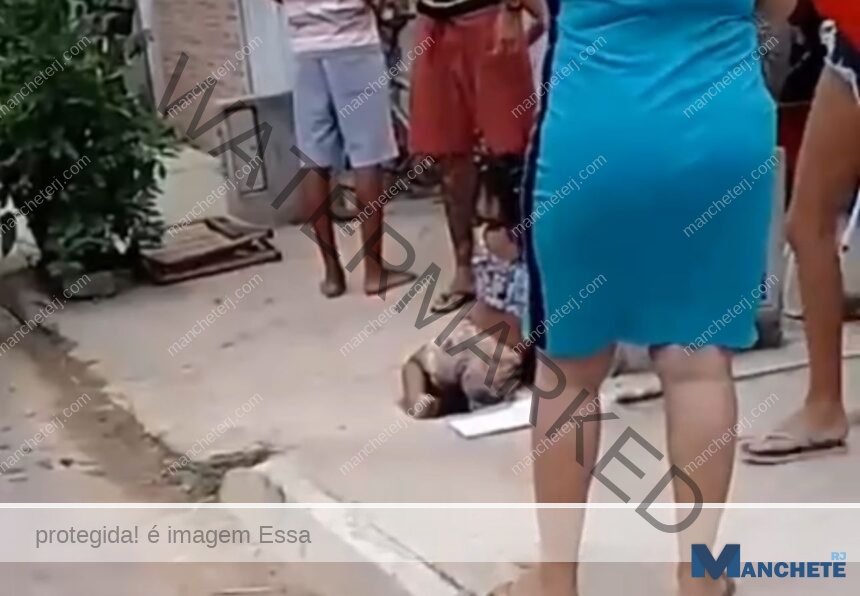 Criança cai em buraco e tem perna perfurada por vergalhão, na Baixada Campista
