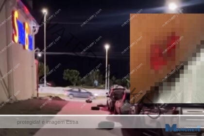 Criança fica ferida após cair em buraco na calçada do SuperBom
