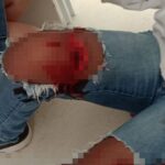Briga entre adolescentes termina com estudante gravemente ferida por lâmina dentro de escola