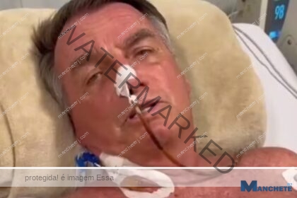 Bolsonaro passa por cirurgia para desobstruir intestino e reconstruir parede abdominal
