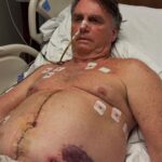 Bolsonaro completa uma semana pós-cirurgia com ‘pressão controlada’, mas segue na UTI