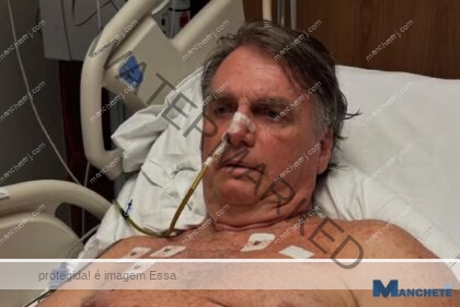 Bolsonaro completa uma semana pós-cirurgia com ‘pressão controlada’, mas segue na UTI