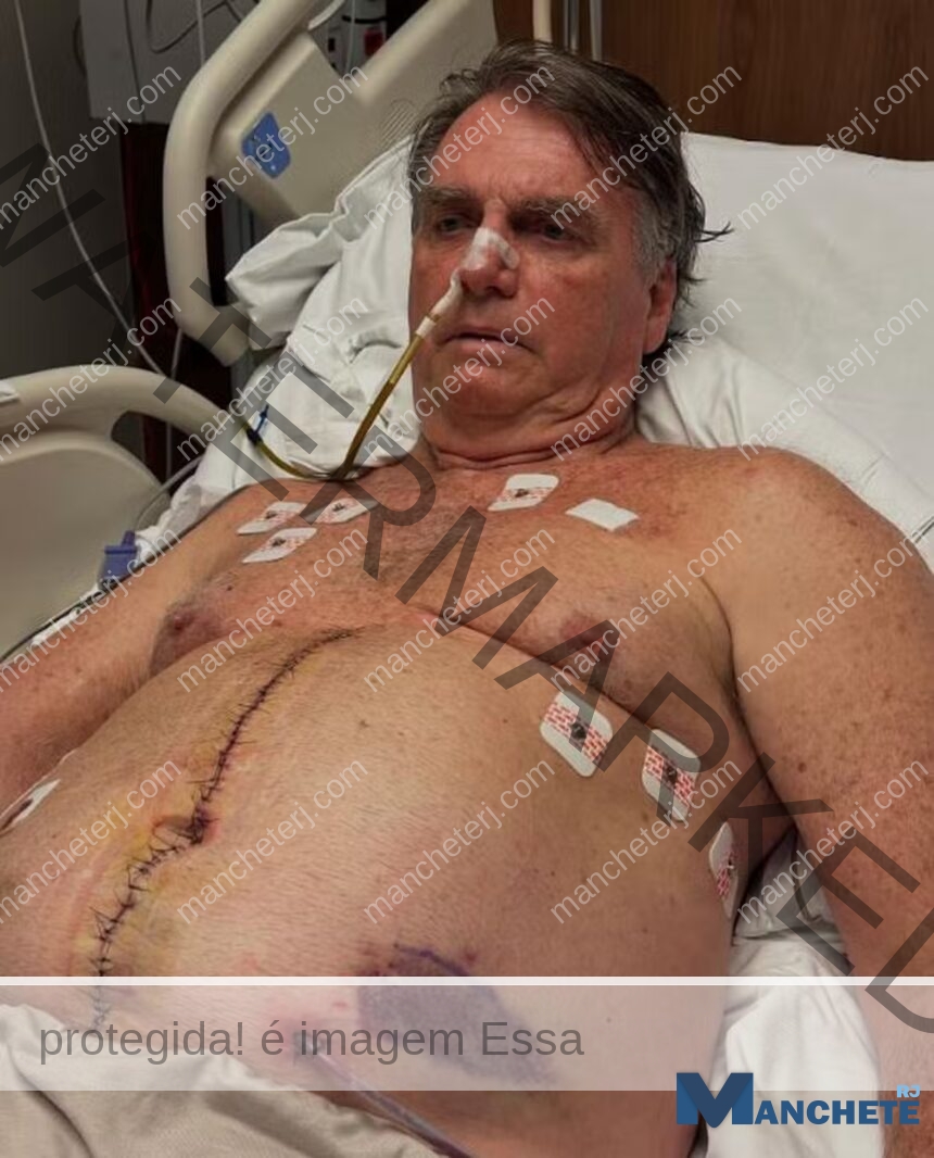 Bolsonaro completa uma semana pós-cirurgia com ‘pressão controlada’, mas segue na UTI