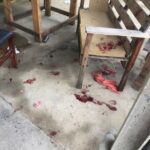 Ataque de pitbull em Campos deixa bebê em estado grave e mais duas pessoas feridas