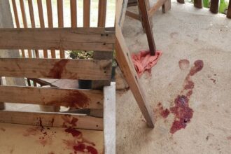 Bebê atacado por pitbull passa por cirurgia e segue grave no HFM