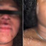 Modelo campista diz ter sido agredida por casal na saída de show no Balneário em Atafona