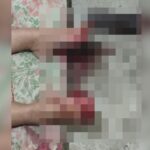 Morre mulher que teve dedos decepados pela filha em Itaperuna