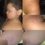 Mãe afirma que filho autista não verbal foi agredido dentro de escola particular em Campos